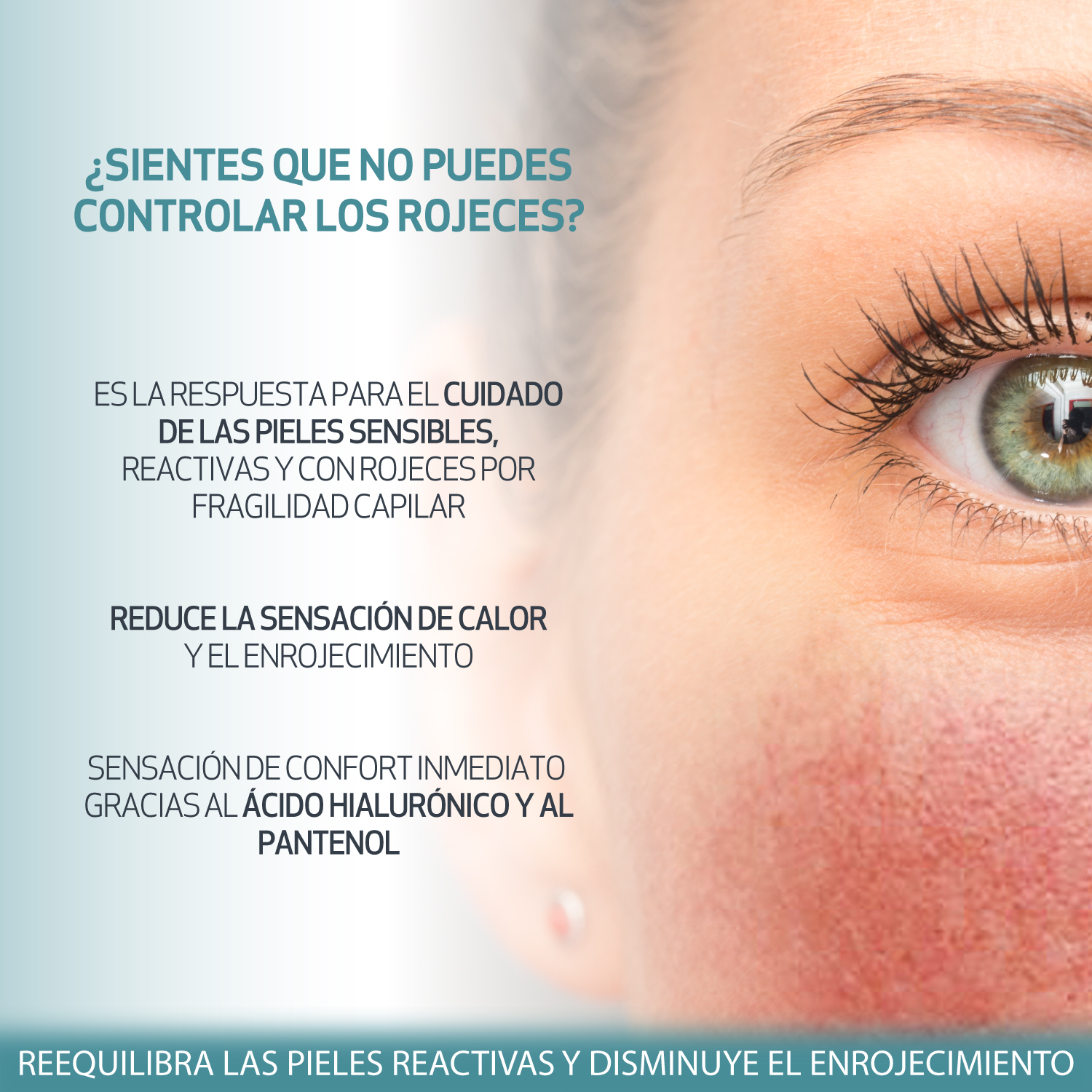 azelac,hidratante,rojeces,sesderma